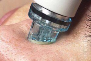HydraFacial Симферополь
