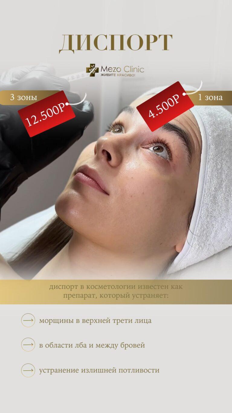 Диспорт акция